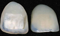 Veneer